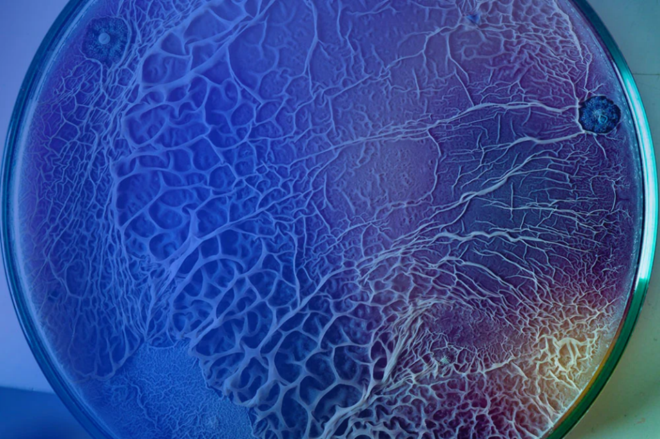 Biofilme, die unsichtbare Gefahr