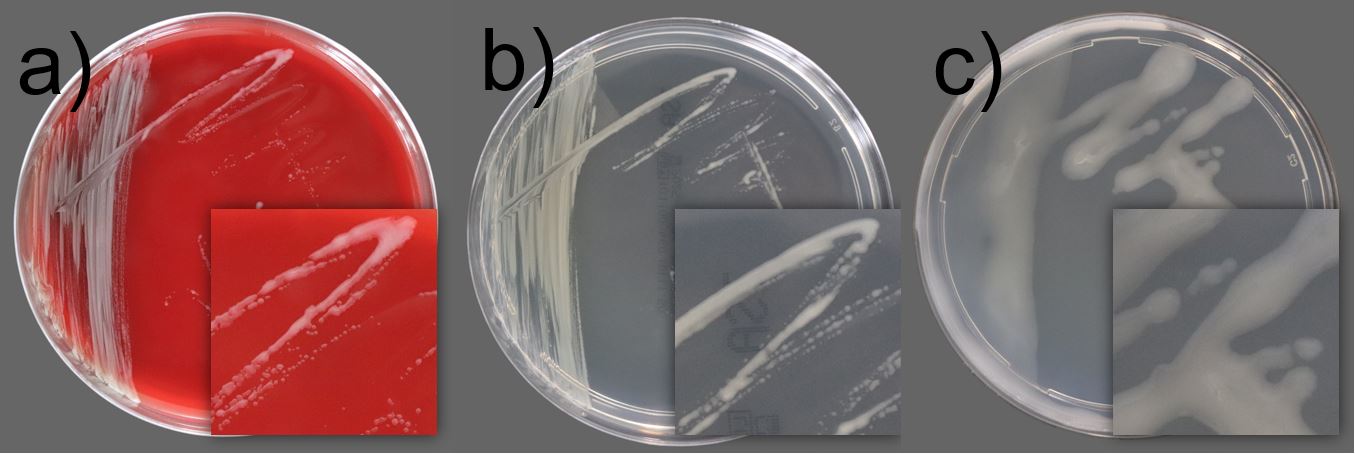 Filtergängige Bakterien - Risiko bei der aseptischen Herstellung